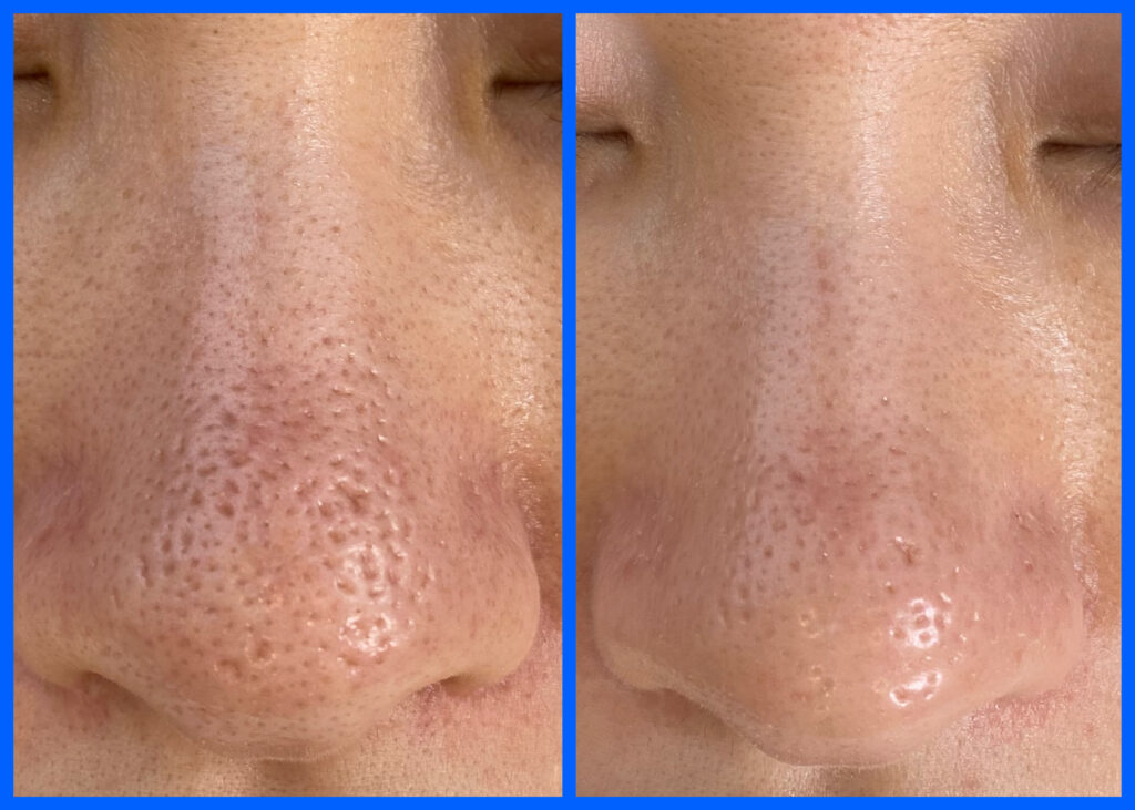 プロセルセラピーズ  施術事例